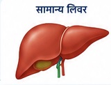 Fatty Liver Symptoms