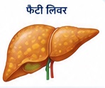 Fatty Liver Symptoms